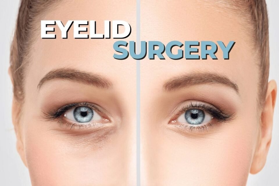 eyelid surgery in Dubai