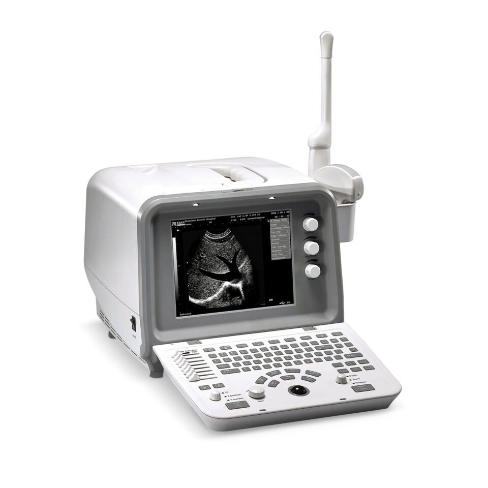 Fully Digital Ultrasound Machine Price in Lahore Key Considerations for Buyers